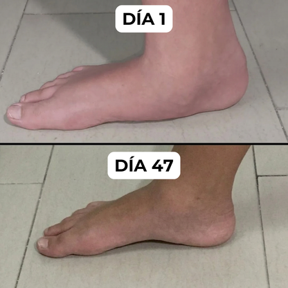 InFoot® - Plantillas Ortopédicas BioForm
