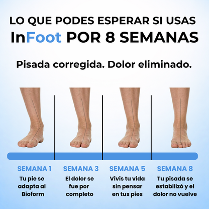 InFoot® - Plantillas Ortopédicas BioForm